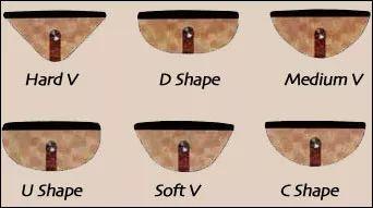 04687a05ad3d40a78f9fce3b66bb5466.jpeg